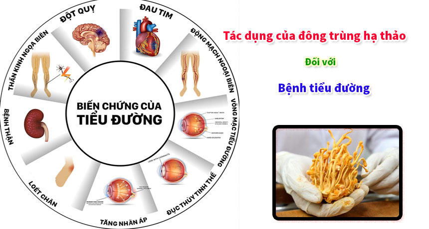 Hỗ trợ điều trị bệnh tiểu đường loại 2   