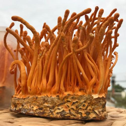 Người chuẩn bị phẫu thuật