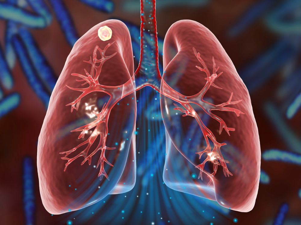 4. Hỗ trợ hệ hô hấp