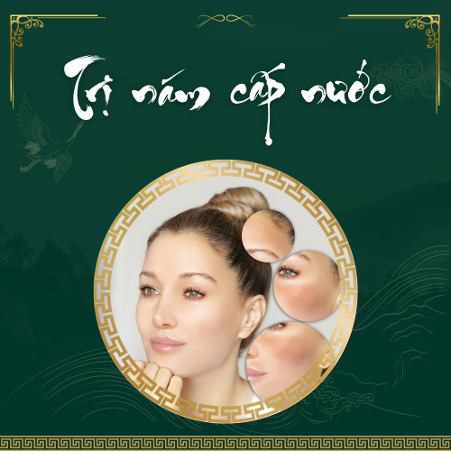 Quy trình điều trị nám bằng laser