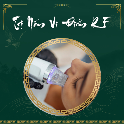 Ai không nên điều trị nám bằng laser?