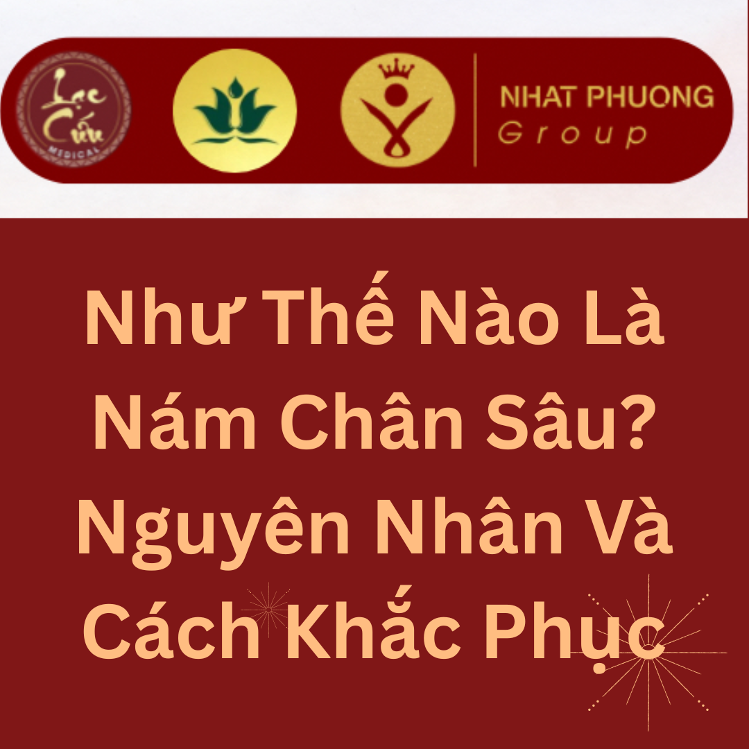 Như Thế Nào Là Nám Chân Sâu? Nguyên Nhân Và Cách Khắc Phục