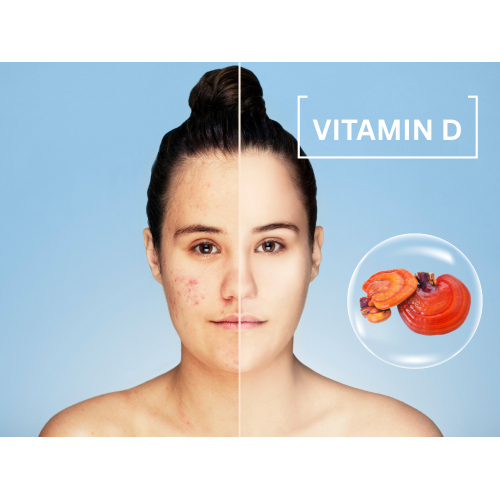 Điều trị mụn trứng cá